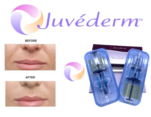 얼굴 주름 충진을 위한 2x1ml 크로스 연결된 주이더텀 피부 필러
