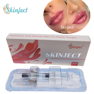 주사 가능한 스키니에트 깊이인 히알루론산 피부에 관한 2 밀리람베르트 LIP 충전기