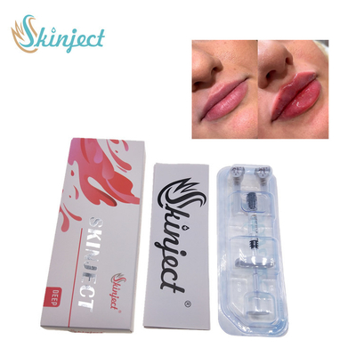 주사 가능한 스키니에트 깊이인 히알루론산 피부에 관한 2 밀리람베르트 LIP 충전기