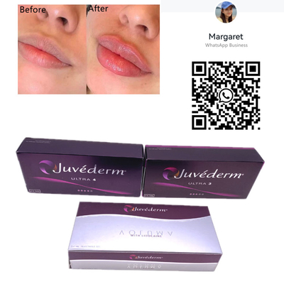 주이더텀 피부 필러 2x1ml 주사기는 교차하는 연결된 겔 Lip 주입을 자극합니다