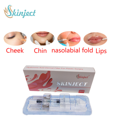주사 가능한 스키니에트 깊이인 히알루론산 피부에 관한 2 밀리람베르트 LIP 충전기