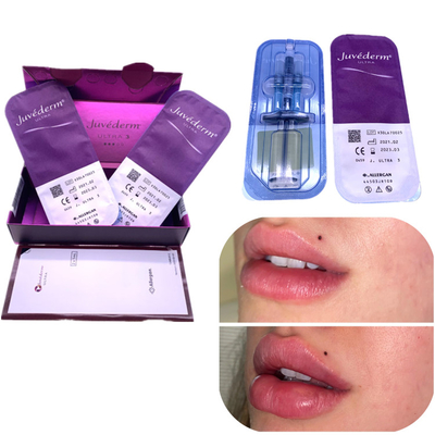 주입 Ha 충전기 주이더텀 2x1ml Lip 향상 이전 주름