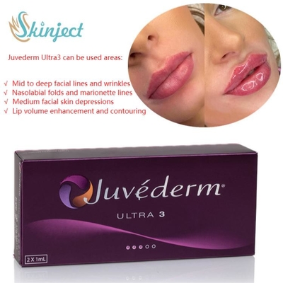 주사 가능한 피부에 관한 얼굴 관리 2x1ml 주이더텀 Lip 충전기 히알루론산