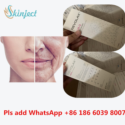 LIP 주입을 위한 히알루론산 피부에 관한 리볼아스 깊 충전기 1 밀리람베르트