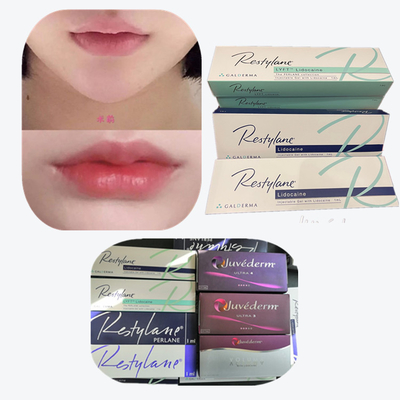 크로스 링크 된 히알루론산 피부 필러 항 노화 제품