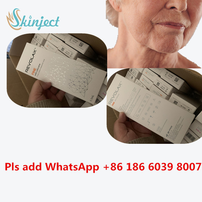 피부 필러 립 주사 순수 HA 크로스 링크드 1ml Deep Dermal Filler for Nose