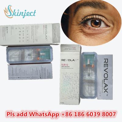 피부 필러 립 주사 순수 HA 크로스 링크드 1ml Deep Dermal Filler for Nose