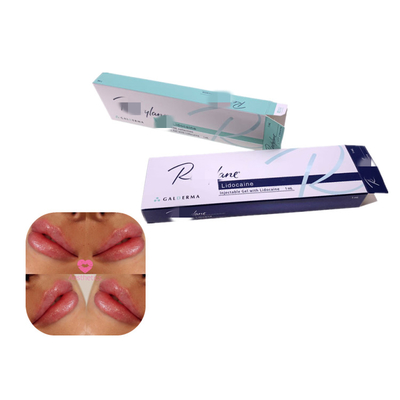 크로스 링크 된 히알루론산 젤 1ml 안티 주름 주입 필러 입술 확대