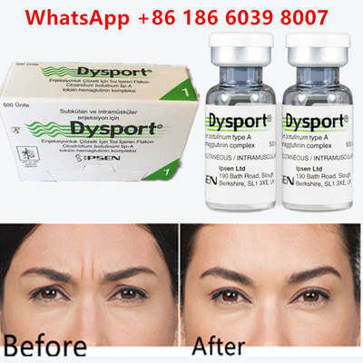 Botulinum Toxin Dysport 100u Clostridium Botulinum Type A forehead wrinkles에 대한 Botulinum Toxin 100u Clostridium Botulinum A형