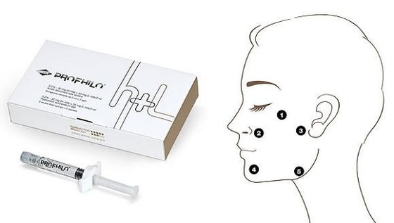 노화 방지 및 주름 제거 프로필로 H L 2ml 히알루론산 32mg/ml Ha 농도