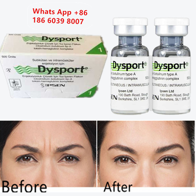 Botulinum Toxin A Dysport 주입 가능한 보톡스