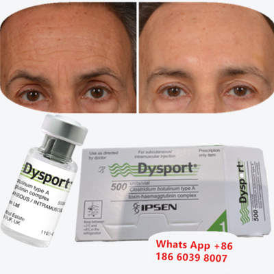 Dysport Botulinum Toxin Type A for Frown and Glabellar Lines (얼굴과 눈의 선에 대한 디스포트 보툴리넘 독성물질 A)