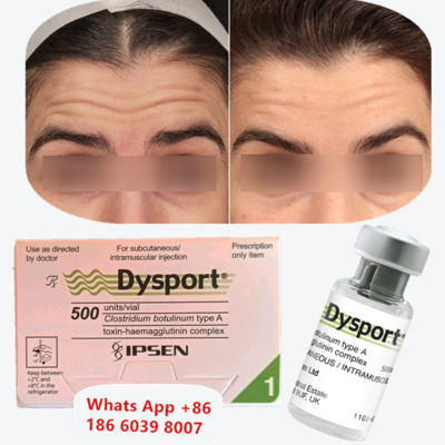 Botulinum Toxin Dysport 안티 주름 냉동 건조 분말