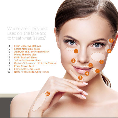 Skinject 히알루론산 젤 필러 주입 이마 주름 제거