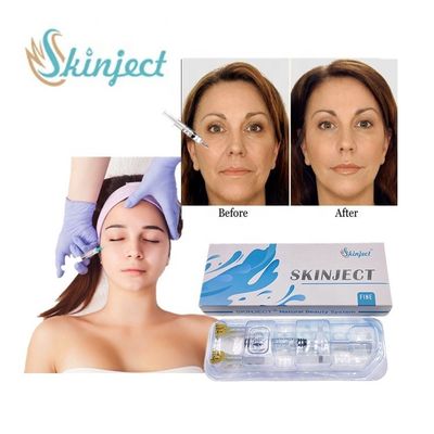 Skinject 1ml 정밀한 히알루론산 충전물 노화 방지 주름 주입 피부 충전물