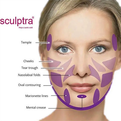 CE  PLLA 파우더 자극 콜라겐