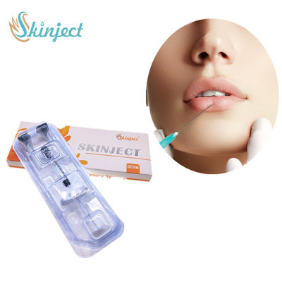 히알루론산 피부 충전물 입술 주입 1ml 2ml 5ml 진피 입술 임플란트