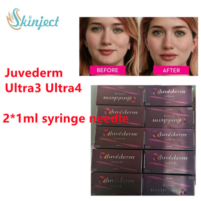 리도카인 2x1ml Ultra3 Ultra4와 주이더텀 히알루론산 피부 필러 주이더텀 Lip 충전기