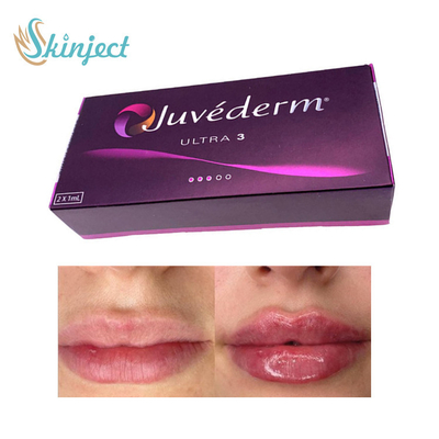 피부에 관한 281ML 히알루론산 Lip 충전기 주이더텀 Ultra3