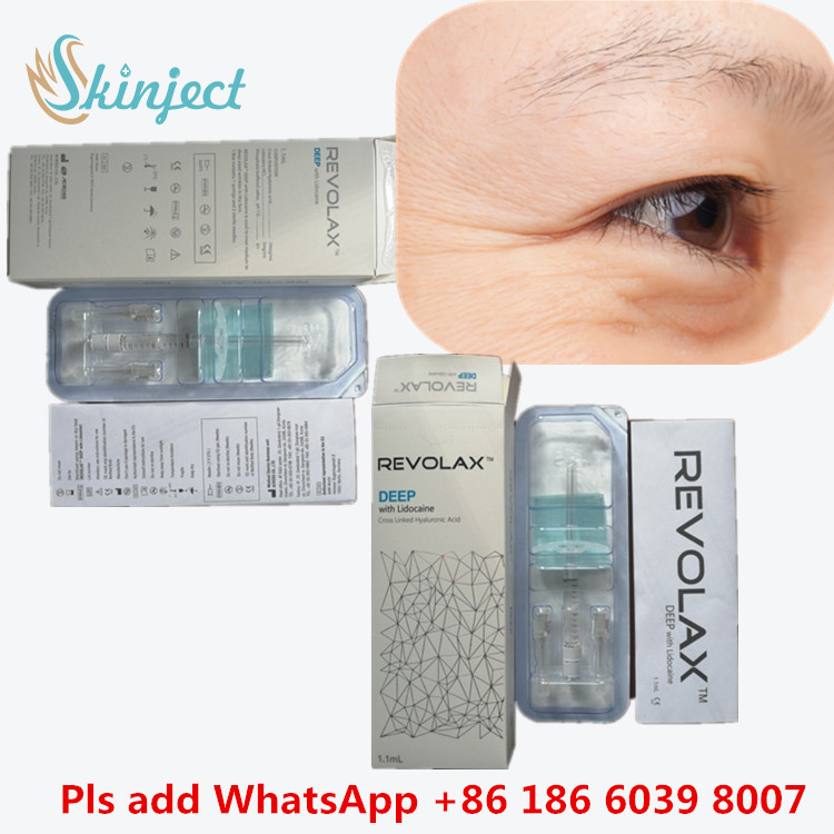 피부 필러 립 주사 순수 HA 크로스 링크드 1ml Deep Dermal Filler for Nose