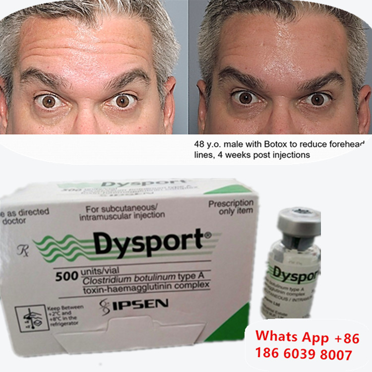 Botulinum Toxin Dysport 보톡스 클로스트리디움 보툴리움 A형