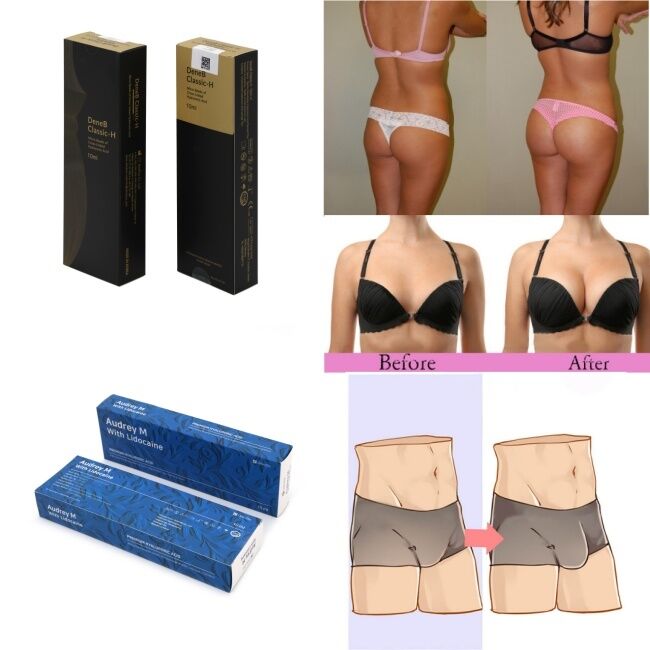 10ml 20ml 순수한 히알루론산 필러 유방 및 엉덩이 증강