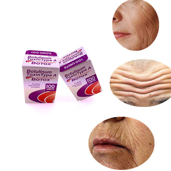 미용실 알레르기 항원 한국 Botulinum Toxin Anti Aging and Wrinkle Removal
