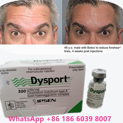 Botulinum Toxin 보톡스 파우더 디스포트 100 IU/1 플라일 노화 피부